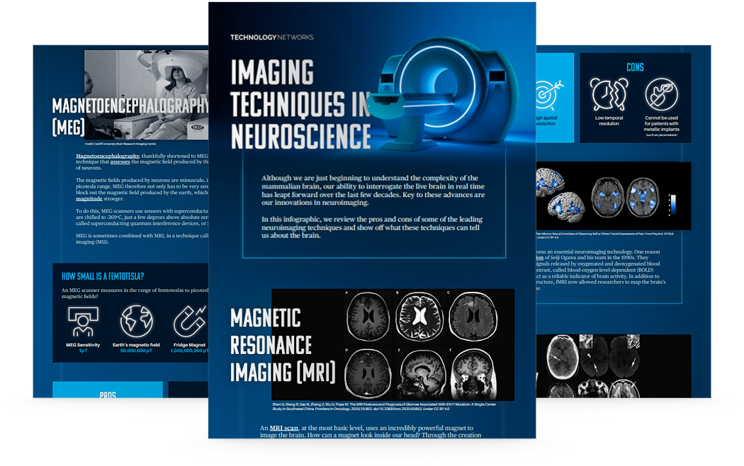 Imaging Techniques in Neuroscience